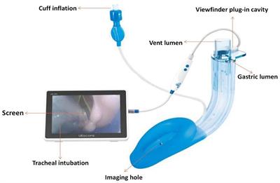 The Application of a SaCoVLMTM Visual Intubation Laryngeal Mask for the Management of Difficult Airways in Morbidly Obese Patients: Case Report